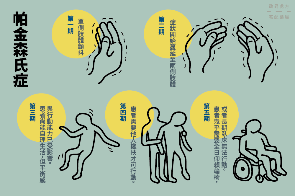 帕金森病的5個(gè)階段