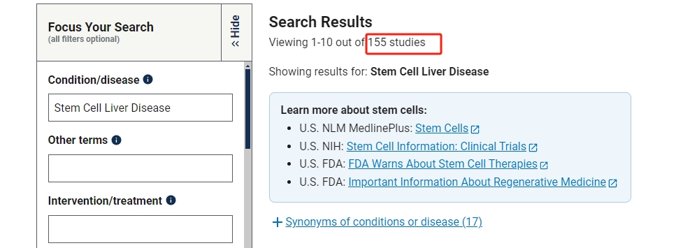 干細胞治療肝病的臨床研究進(jìn)展