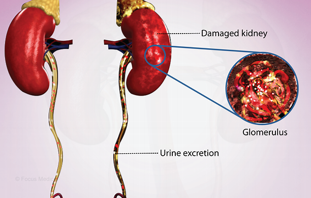 近10年國內進(jìn)行干細胞治療急性腎損傷臨床研究的醫院有哪些？