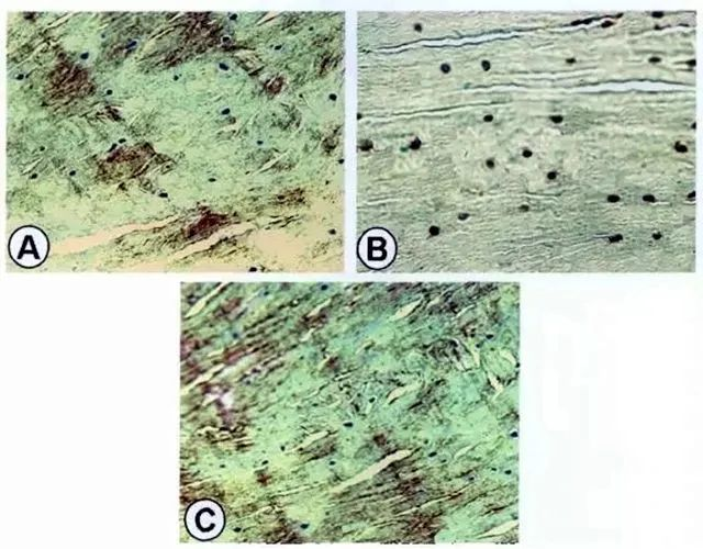 A為紅-紅區修復組織II型膠原的表達；B為紅-紅區修復組織S-100蛋白表達；C為紅-紅區修復組織I型膠原表達。