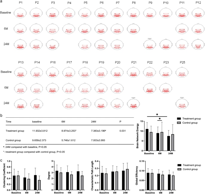 腦網(wǎng)絡(luò )能量變化