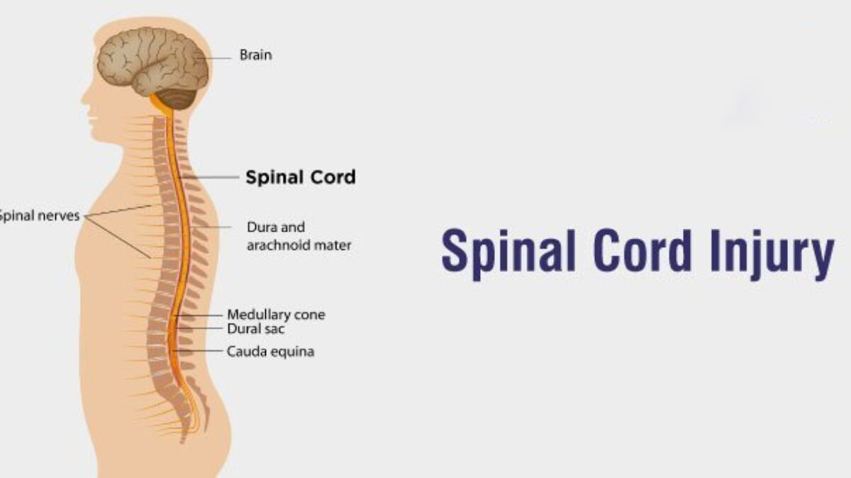 3項研究75例患者，評估干細胞治療脊髓損傷的安全性和有效性