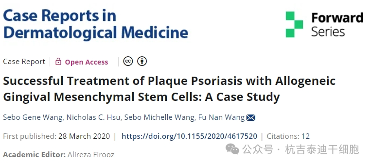 同種異體牙齦間充質(zhì)干細胞成功治療斑塊性銀屑?。喊咐芯? class=