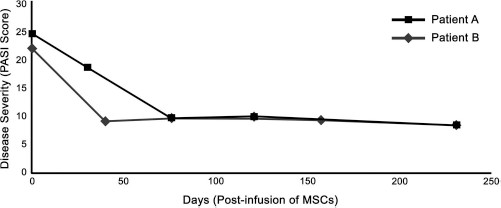 圖 1?. 移植 MSCs 前后兩例患者的銀屑病面積和嚴重程度指數 (PASI) 評分總結。在輸注 MSCs 后的隨訪(fǎng)中，每例患者的 PASI 評分均有所下降。評分由第三方皮膚科醫生進(jìn)行。臨床改善持久，患者 A 的改善持續超過(guò) 150 天，患者 B 的改善持續超過(guò) 200 天。