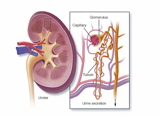 狼瘡性腎炎的腎解刨圖