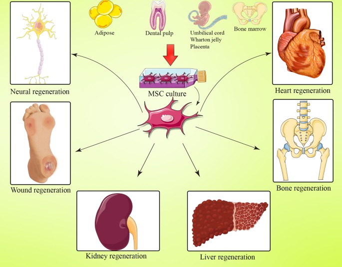 間充質(zhì)干細胞(MSC) 是一種多能細胞，可分化為基質(zhì)譜系細胞。間充質(zhì)干細胞(MSC) 是骨髓 (BM-MSC)、脂肪組織、肝臟、羊水、胚胎胎盤(pán)、臍帶血和其他組織中的一組非造血細胞。骨髓間充質(zhì)干細胞能夠抑制與GVHD病理生理學(xué)有關(guān)的大多數免疫細胞的激活和功能。