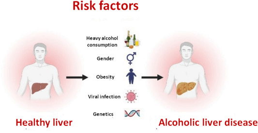 酒精性肝病風(fēng)險因素