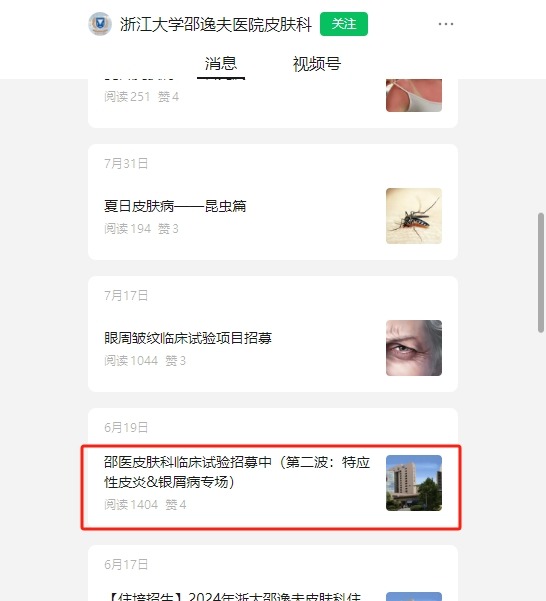 干細胞臨床招募：邵逸夫醫院招募特應性皮炎濕診患者參與治療！