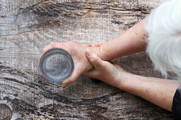 治療帕金森病的方案有那5大種？目前干細胞治療帕金森病前景如何？