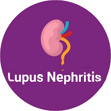 南京鼓樓醫院：干細胞治療92例狼瘡性腎炎，效果顯著(zhù)！