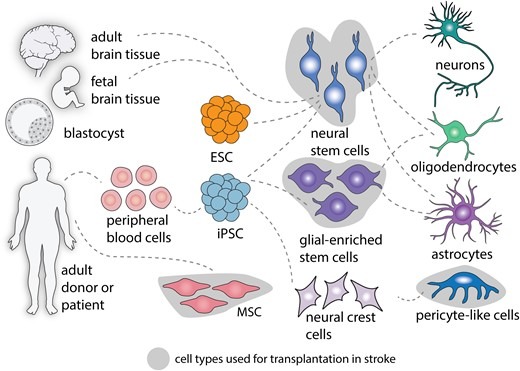 圖2：中風(fēng)后細胞治療的細胞類(lèi)型。