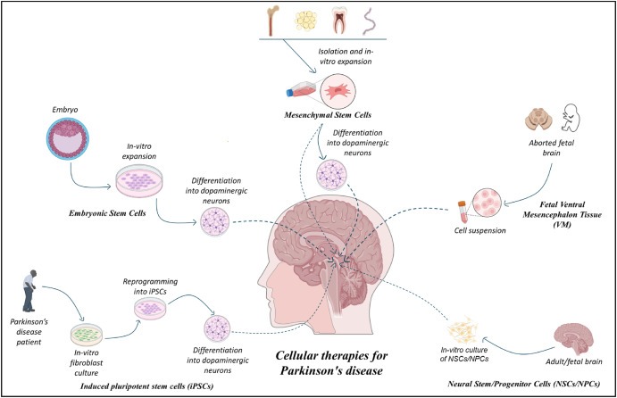 圖1：帕金森病的細胞療法：胚胎干細胞 (ESC)、誘導性多能干細胞 (iPSC)、間充質(zhì)干細胞 (MSC)、神經(jīng)干細胞/祖細胞 (NSC/NPS) 是帕金森病的新興候選藥物。