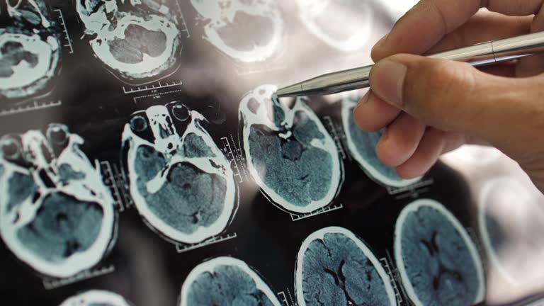 事關(guān)神經(jīng)退行性疾病，干細胞在治療神經(jīng)退行性疾病的療效、倫理、安全等問(wèn)題的綜述