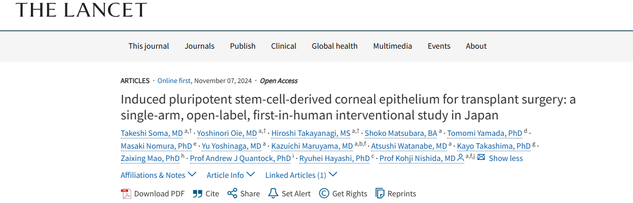 《誘導性多能干細胞來(lái)源的角膜上皮用于移植手術(shù)：日本的一項單臂、開(kāi)放標簽、首次人體介入研究》