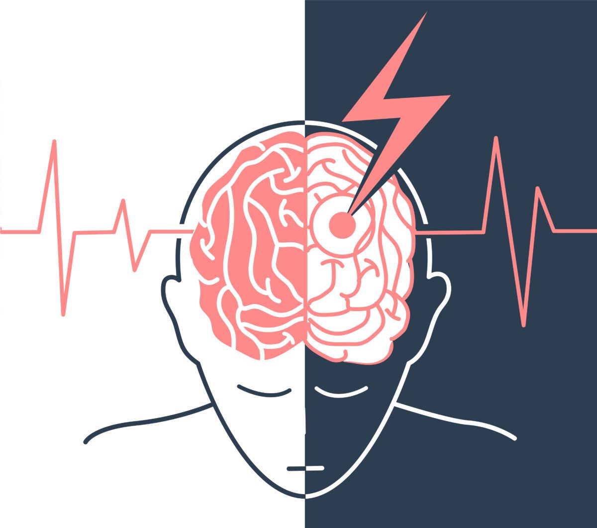 宣武醫院發(fā)布：間充質(zhì)干細胞治療中風(fēng)，可以改善患者神經(jīng)功能障礙