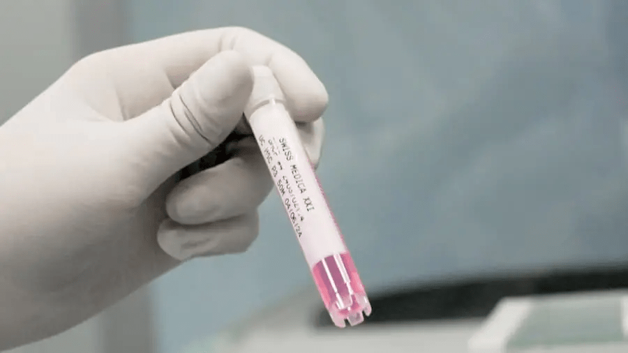 干細胞治療程序：??完整流程和所有步驟！