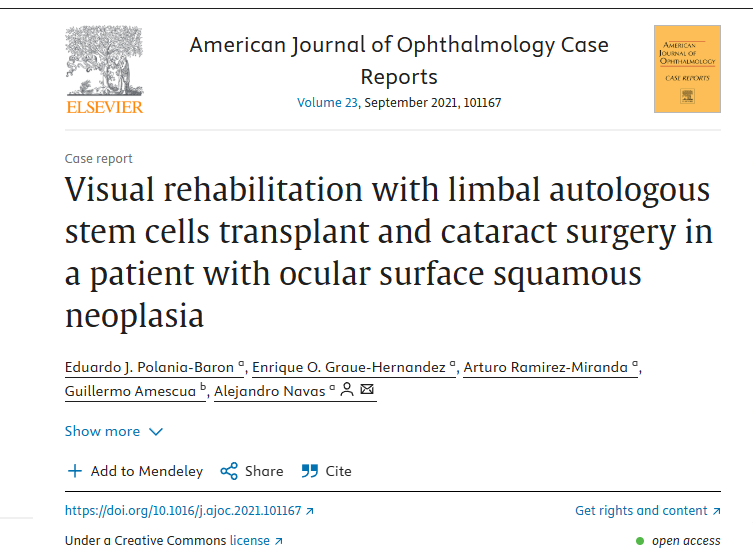 眼表鱗狀細胞瘤患者角膜緣自體干細胞移植及白內障手術(shù)進(jìn)行視力康復