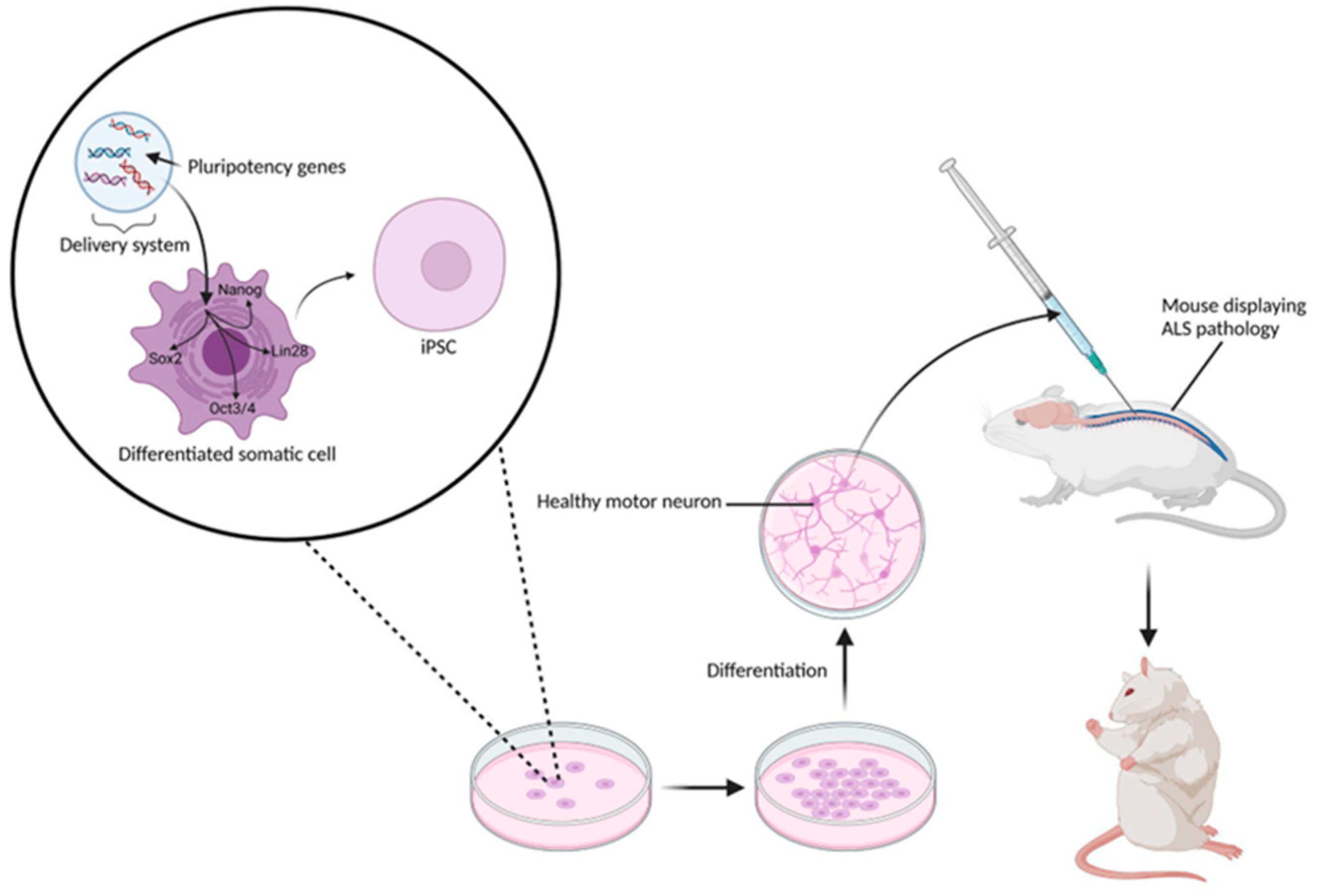 圖4：涉及移植iPSC衍生NSC的典型臨床前實(shí)驗方案