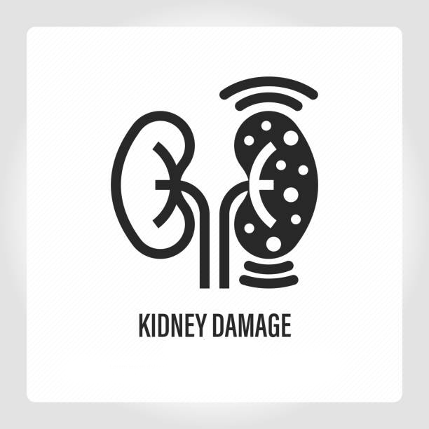 干細胞療法：扭轉腎病患者癥狀的關(guān)鍵力量