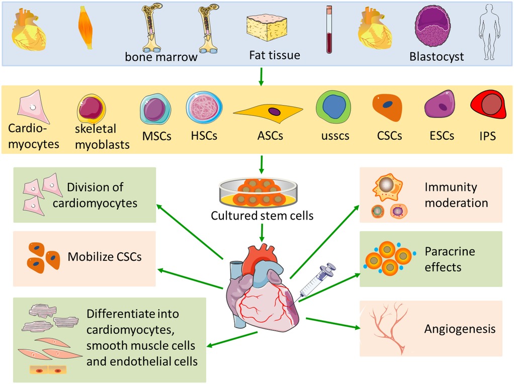 圖1：心肌梗死中的干細胞療法示意圖。