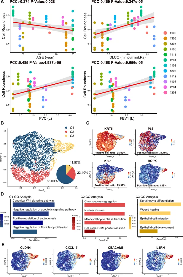 圖2：從IPF患者中分離的P63+肺祖細胞的細胞形態(tài)和單細胞RNA測序分析。