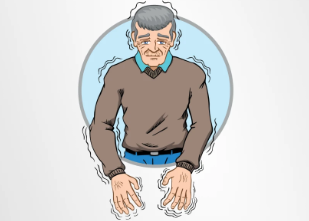 從短期緩解到長(cháng)期穩定：干細胞移植治療帕金森病的療效持續時(shí)間研究