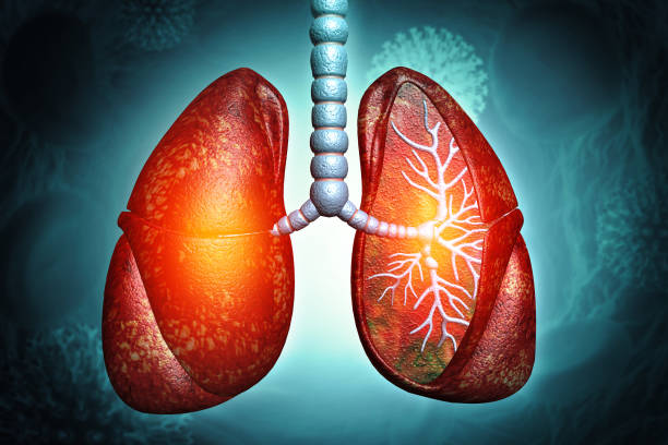 間充質(zhì)干細胞治療4大類(lèi)肺部疾病的臨床試驗進(jìn)展及挑戰