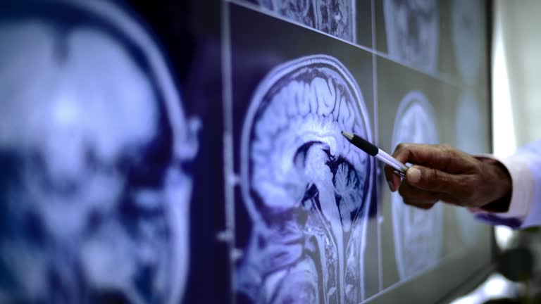 綜述：談?wù)勯g充質(zhì)干細胞治療中風(fēng)的機制、案例及未來(lái)發(fā)展方向