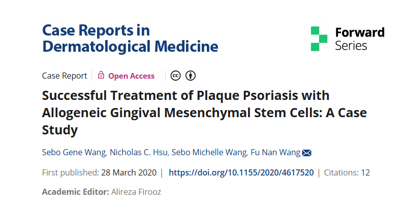 同種異體牙齦間充質(zhì)干細胞成功治療斑塊性銀屑?。喊咐芯? class=