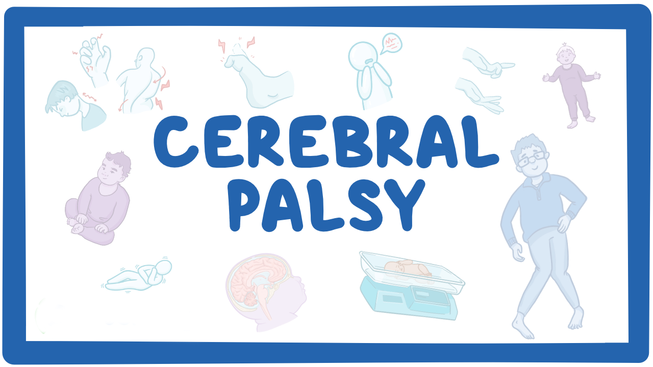 孩子腦癱有救了？神經(jīng)干細胞移植治療腦癱的真實(shí)療效分享