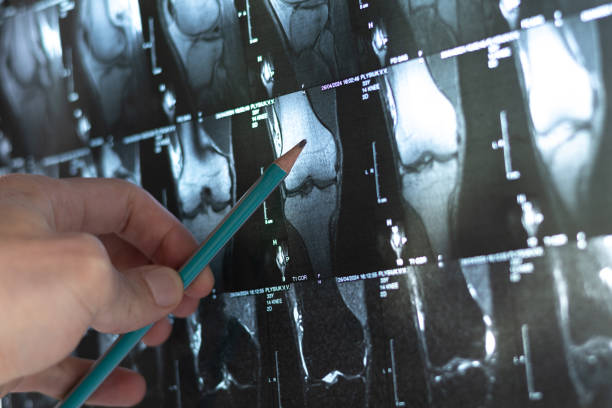 4種細胞療法運用免疫調節和再生機制為治療骨科疾病開(kāi)辟了新方向