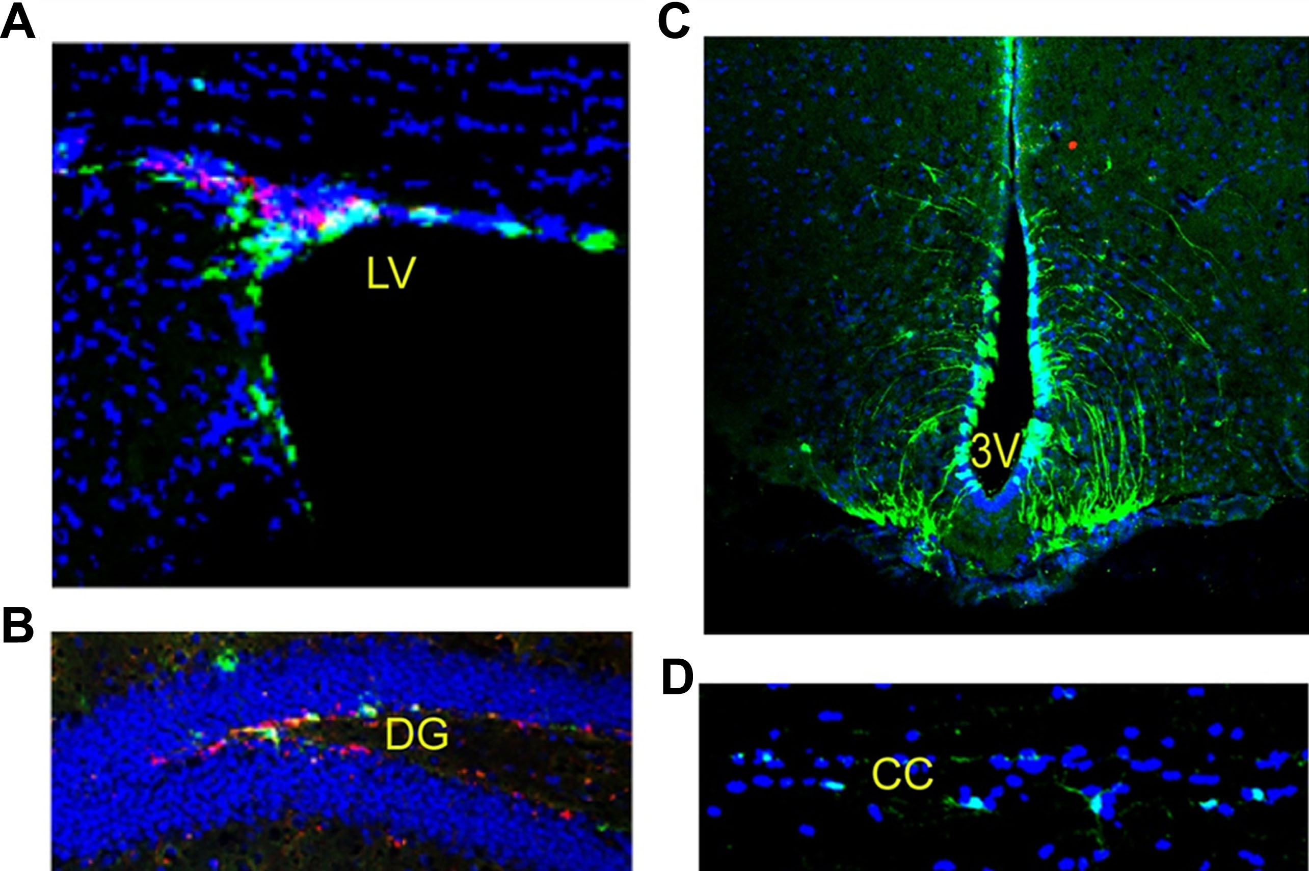 圖2：成年小鼠腦和脊髓中的神經(jīng)干細胞：左腦 (LV)、第三腦室 (DG)、齒狀回 (DG) 和脊髓。