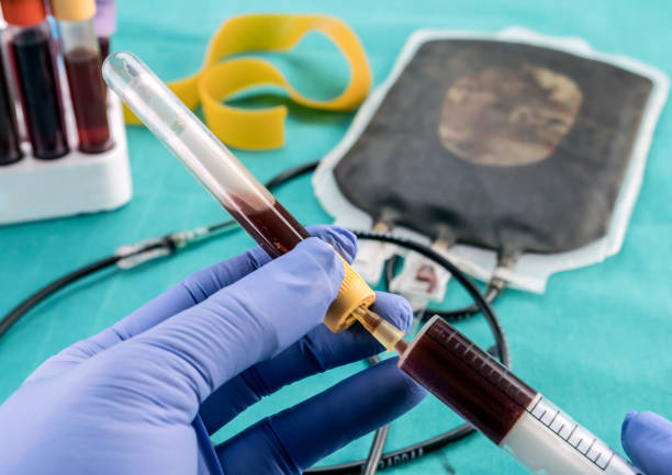 自體干細胞移植費用及副作用：三大客觀(guān)視角下的真相