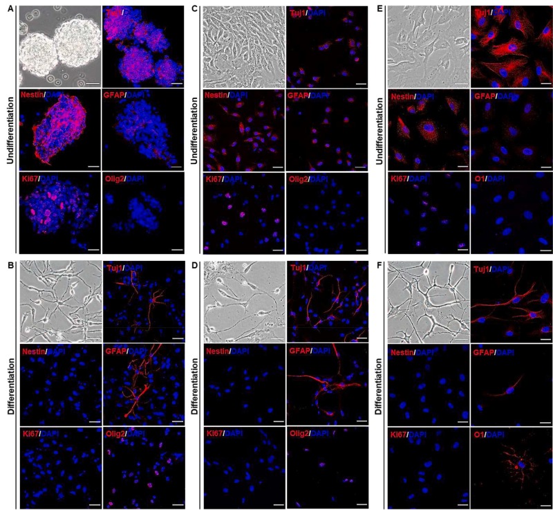 圖1：同基因、同種異體和異種NSC的表征