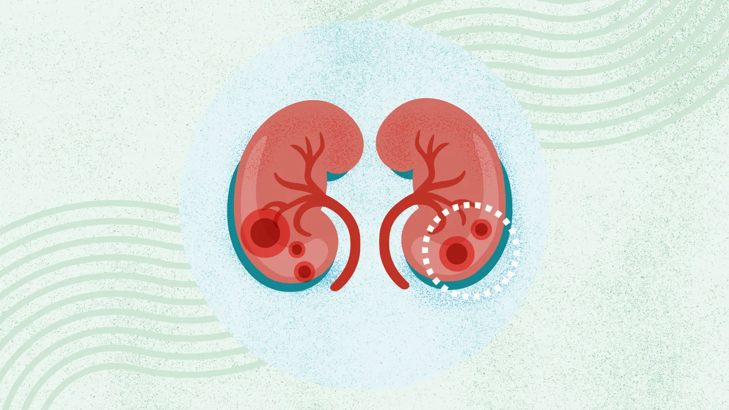 2025年國內干細胞治療腎病的醫院都有哪幾家？