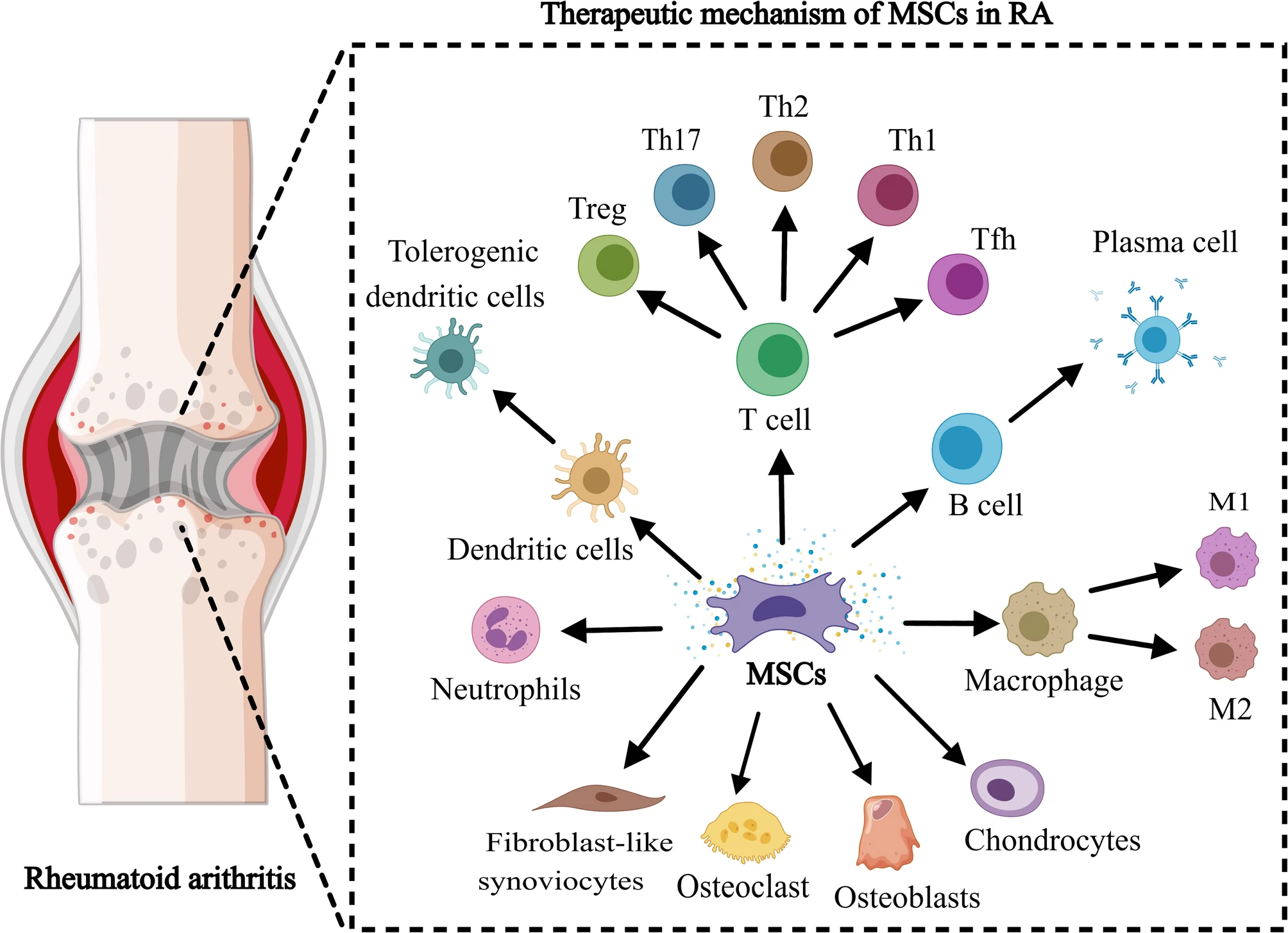 圖3：間充質(zhì)干細胞在治療類(lèi)風(fēng)濕性關(guān)節炎中的機制。