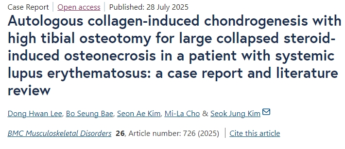 自體膠原誘導軟骨形成聯(lián)合脛骨高位截骨術(shù)治療系統性紅斑狼瘡患者大面積塌陷性類(lèi)固醇性骨壞死：病例報告及文獻綜述
