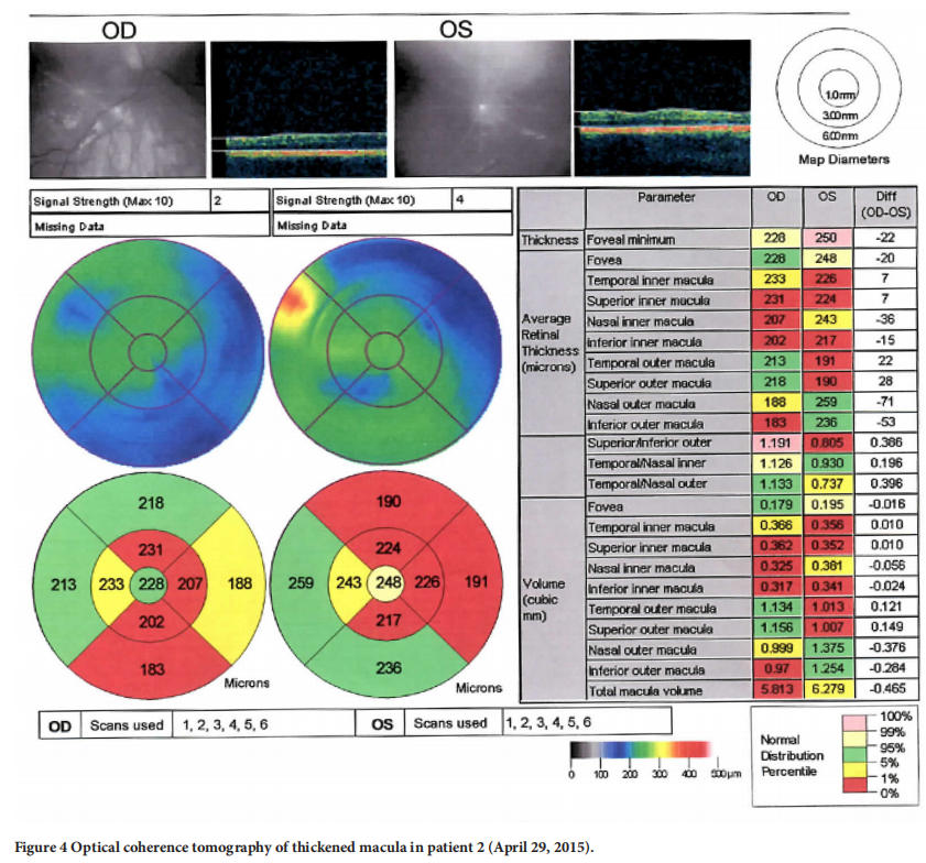 遺傳性視神經(jīng)病變臨床試驗 遺傳性視神經(jīng)病變臨床試驗