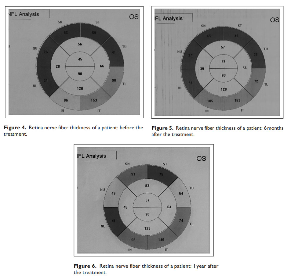 視神經(jīng)萎縮臨床試驗