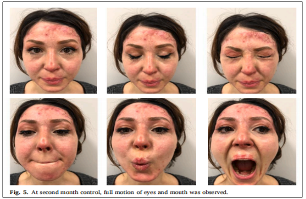 臨床試驗 臨床試驗