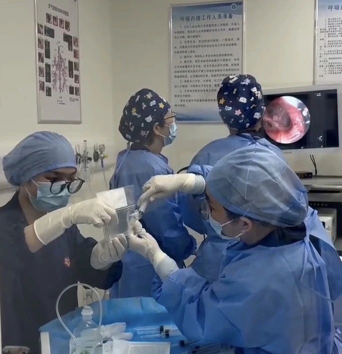 首例慢阻肺病患者順利完成干細胞治療，由瑞金醫院周敏教授(左二）完成支氣管鏡給藥操作