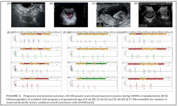 圖2：妊娠和新生兒結果。