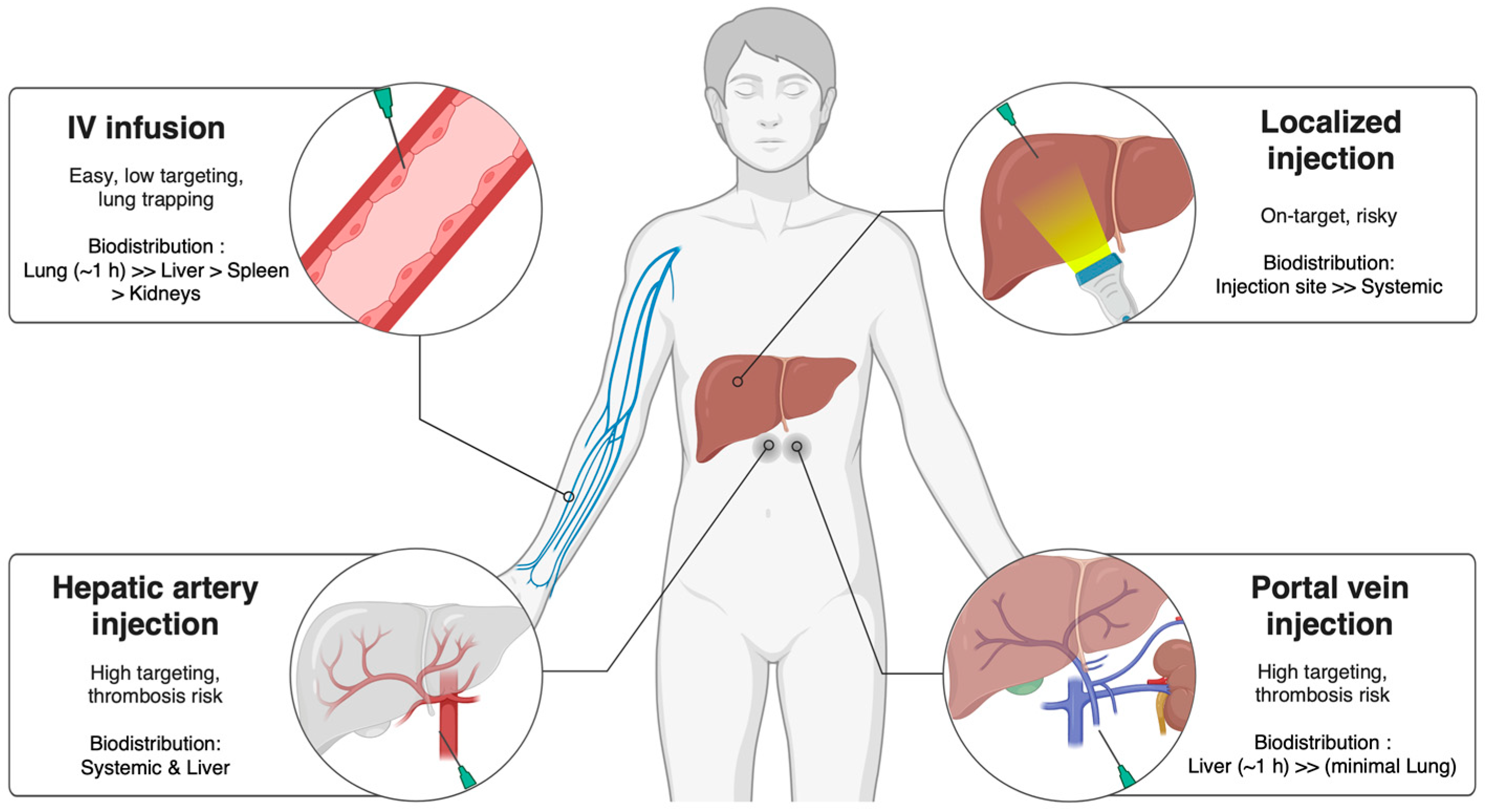 圖2：MSCs和EVs在肝病治療中的遞送途徑。生物分布和治療效果會(huì )受到給藥途徑的影響，例如靜脈注射、門(mén)靜脈注射、肝動(dòng)脈注射或局部注射。