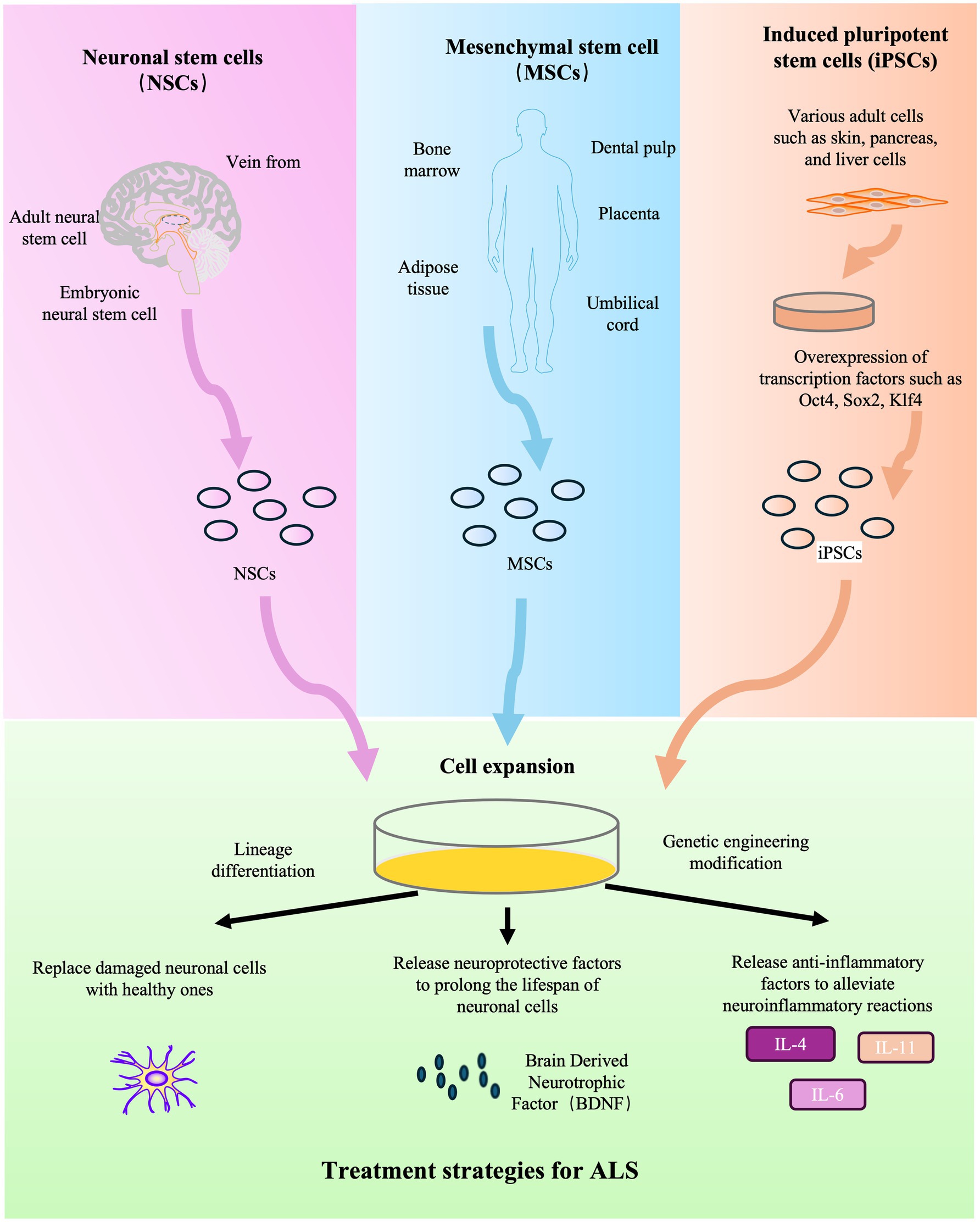 圖2：干細胞療法治療ALS的示意圖。