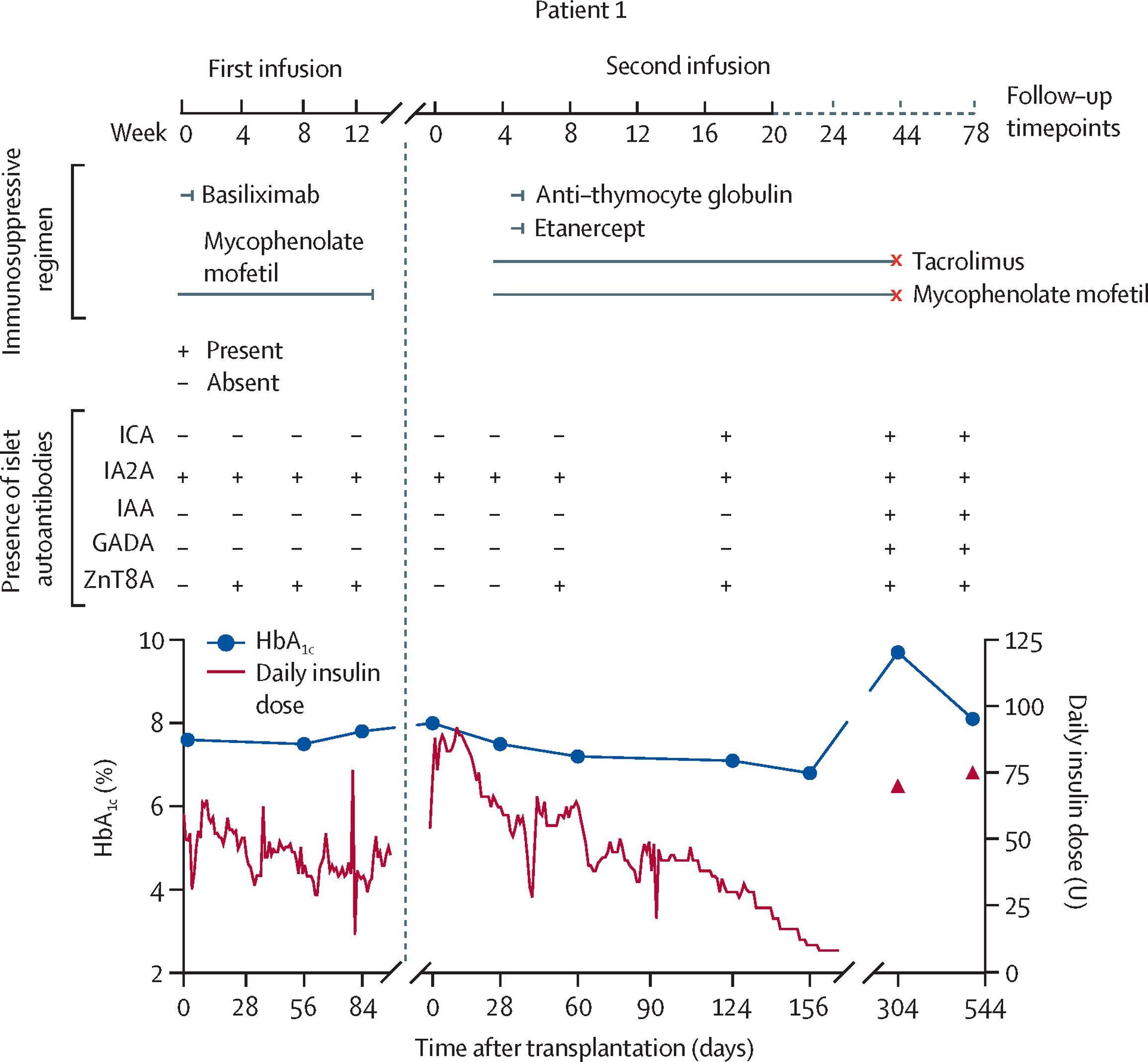 圖1：自體和異體E-胰島移植聯(lián)合不同免疫抑制方案治療患者1的療效