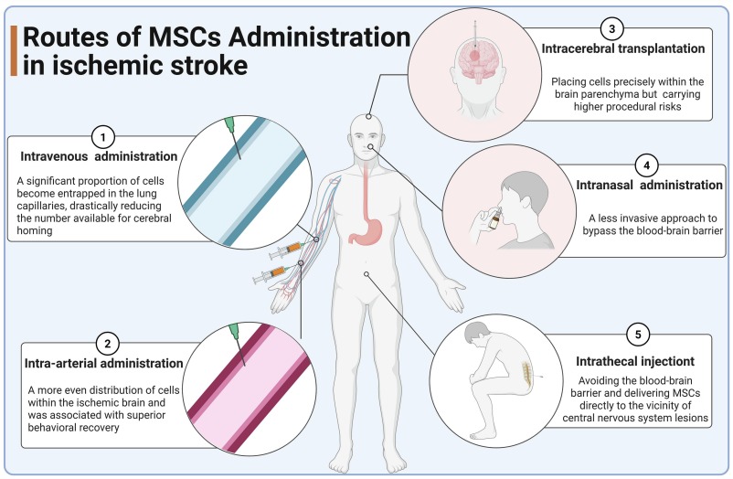 圖6：基于間充質(zhì)干細胞 (MSC) 治療缺血性卒中的主要給藥途徑示意圖。該圖展示了將MSC遞送至大腦的主要策略，每種策略在靶向效率、侵入性和風(fēng)險方面各有側重。
