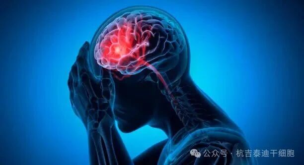 公眾對干細胞治療中風(fēng)認知調查：80.77%認為有益，但療效認知普遍不確定